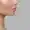 acne scars
