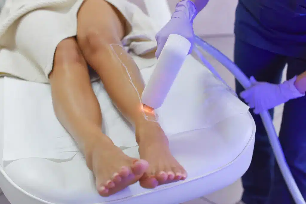 best diode laser hair removal malaysia