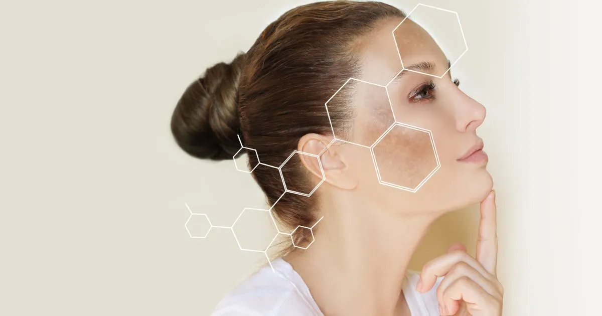 best pigmentation treatment malaysia