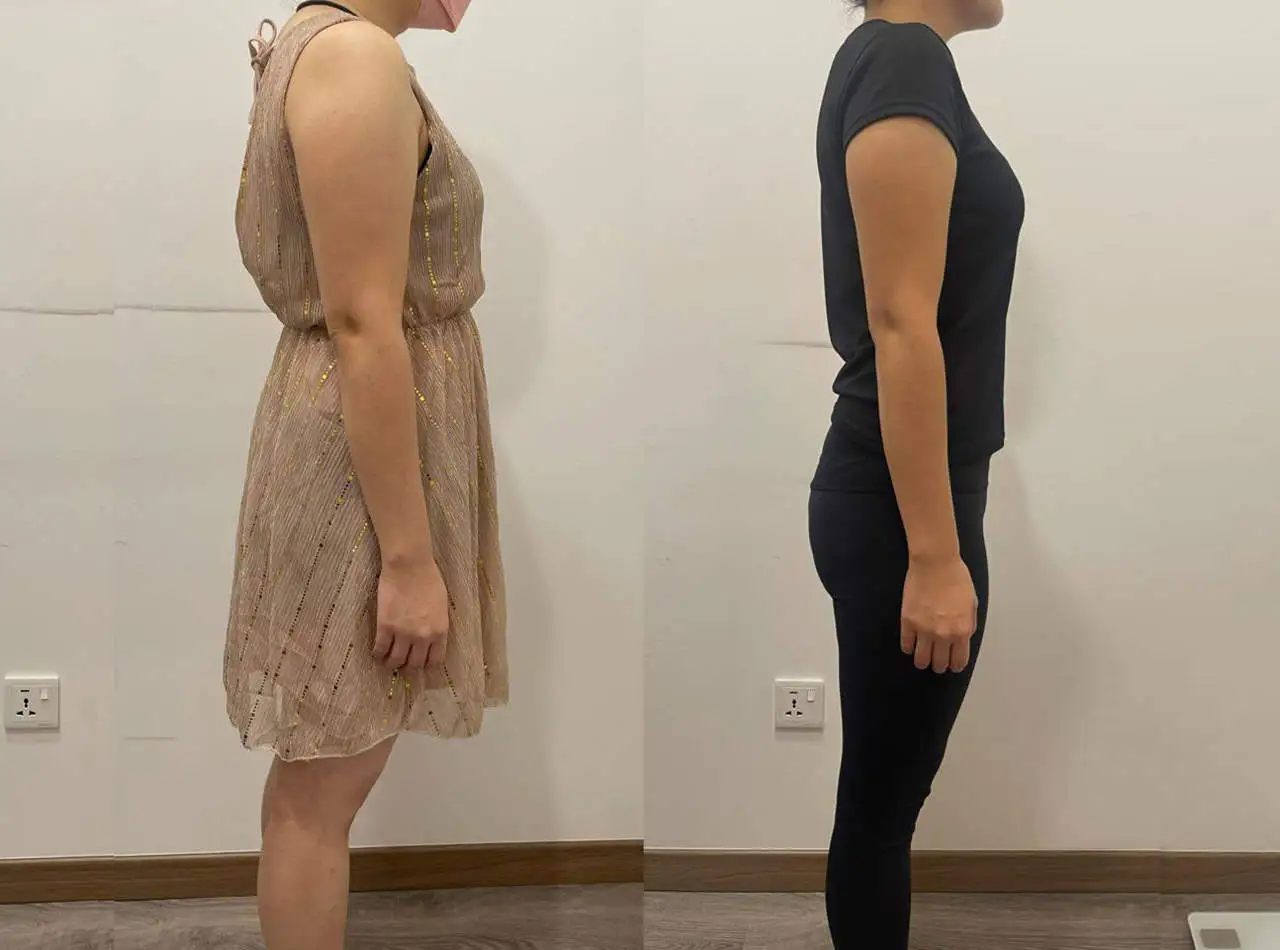 weight loss 1-2111