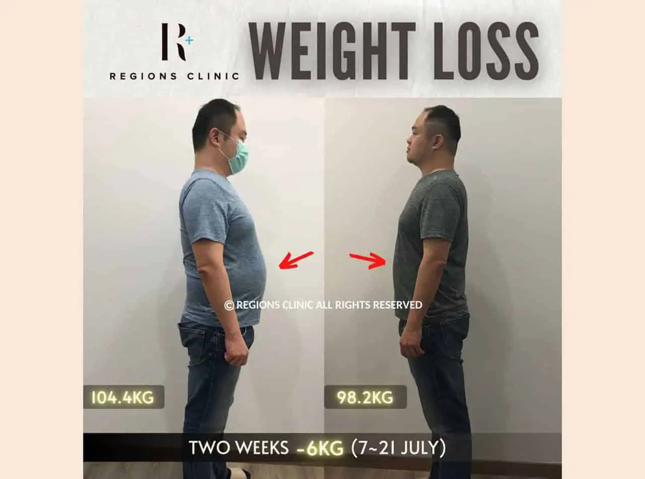weight loss 2-212