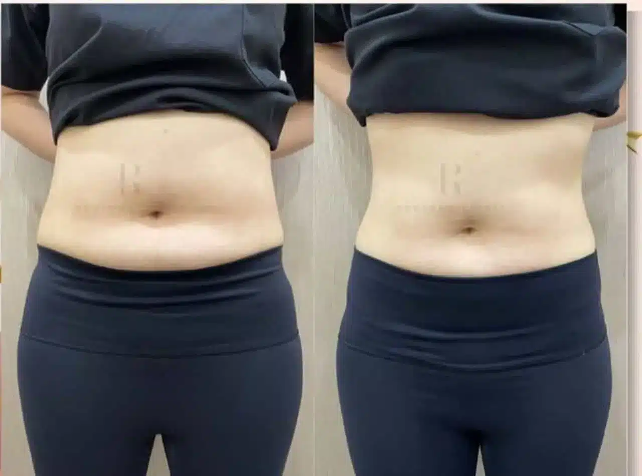 weight loss 41