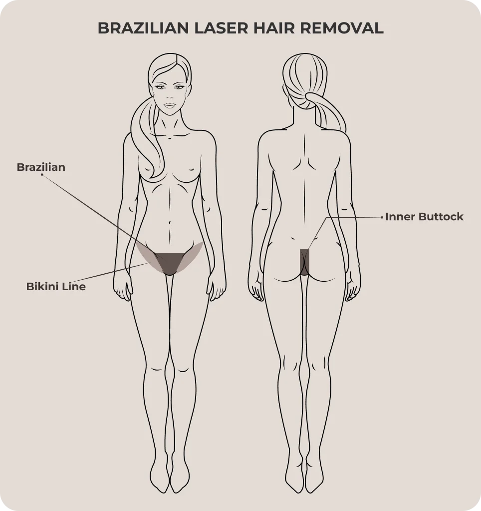 Brazilian Hair Removal Malaysia