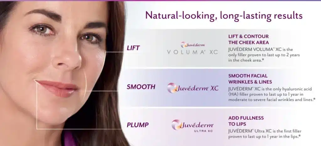 Juvederm Filler Treatment Area