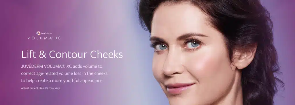 Juvederm Voluma Treatment in Malaysia