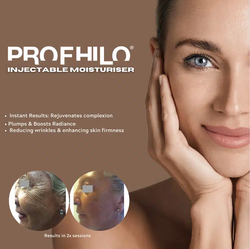 Profhilo Treatment Before and After
