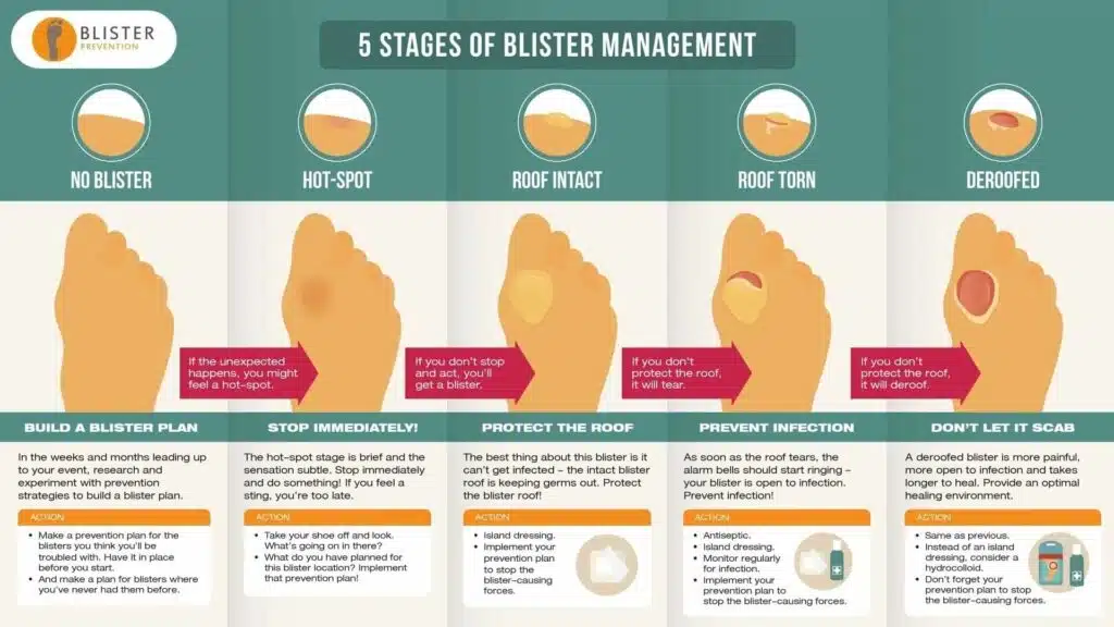 Medical Treatments for Blister