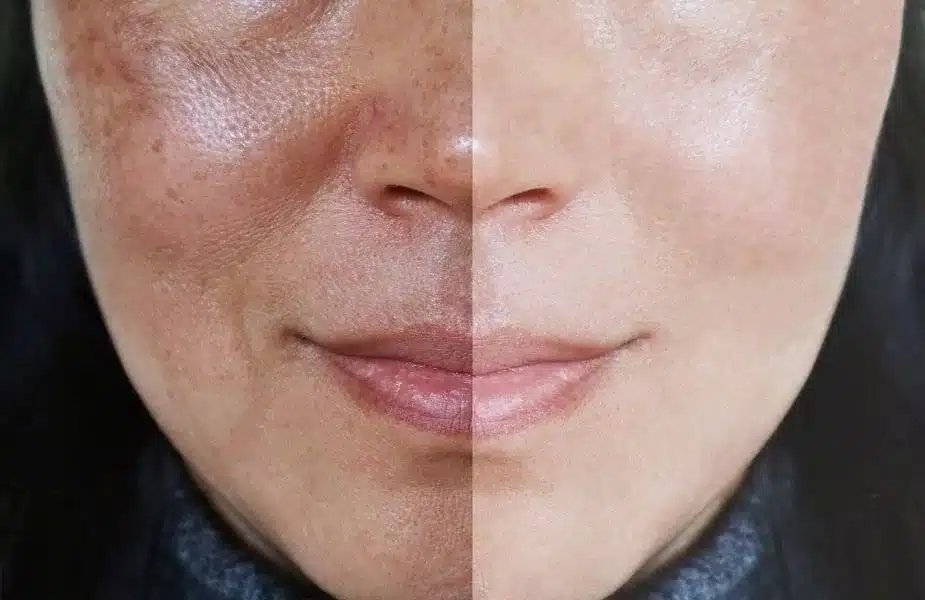 Skincare Untuk Kulit Kusam di Malaysia
