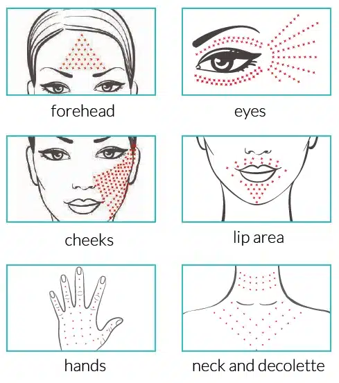 Hyalual Electri Treatment For Dark Circles