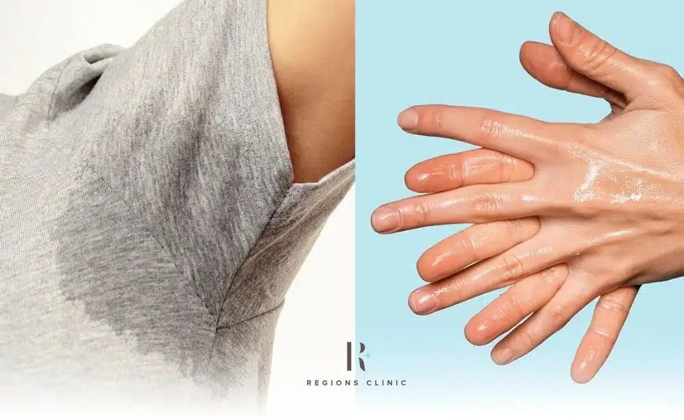 Excessive Armpit Sweating