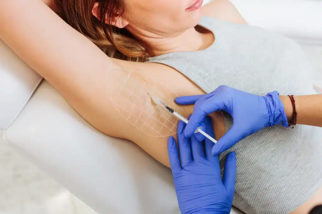 Gold Standard Treatment for Armpit Sweating